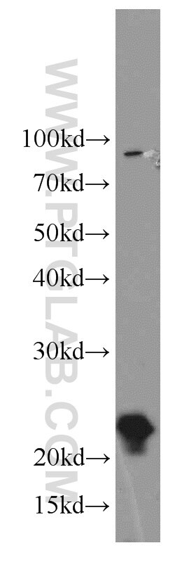 Western Blot (WB) analysis of mouse kidney tissue using PSMB8 Polyclonal antibody (14859-1-AP)