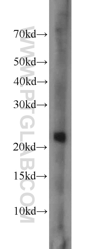 Western Blot (WB) analysis of mouse kidney tissue using PSMB8 Polyclonal antibody (14859-1-AP)