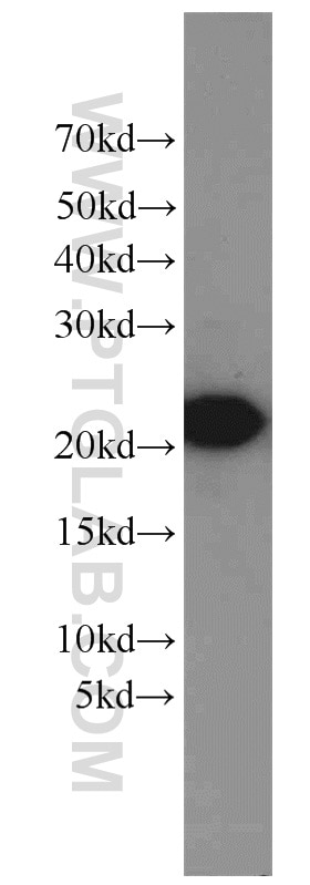 Western Blot (WB) analysis of Jurkat cells using PSMB8 Polyclonal antibody (14859-1-AP)