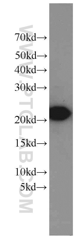 WB analysis of Jurkat using 14859-1-AP