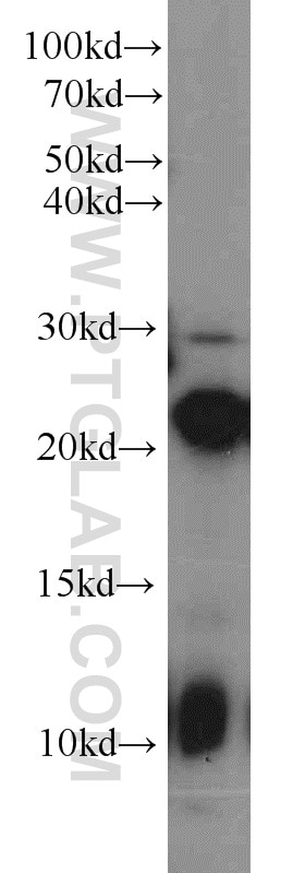 Western Blot (WB) analysis of Raji cells using PSMB8 Polyclonal antibody (14859-1-AP)