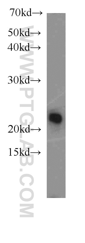Western Blot (WB) analysis of mouse kidney tissue using PSMB8 Polyclonal antibody (14859-1-AP)