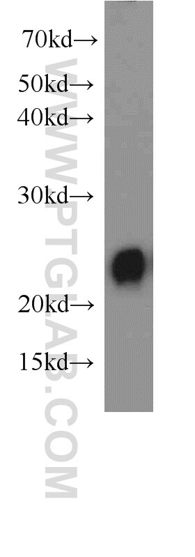 Western Blot (WB) analysis of Raji cells using PSMB8 Polyclonal antibody (14859-1-AP)