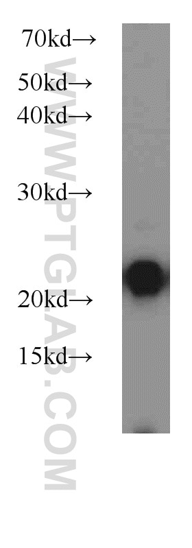 Western Blot (WB) analysis of Raji cells using PSMB8 Polyclonal antibody (14859-1-AP)