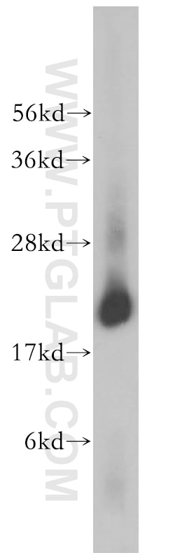 Western Blot (WB) analysis of human kidney tissue using PSMB8 Polyclonal antibody (14859-1-AP)