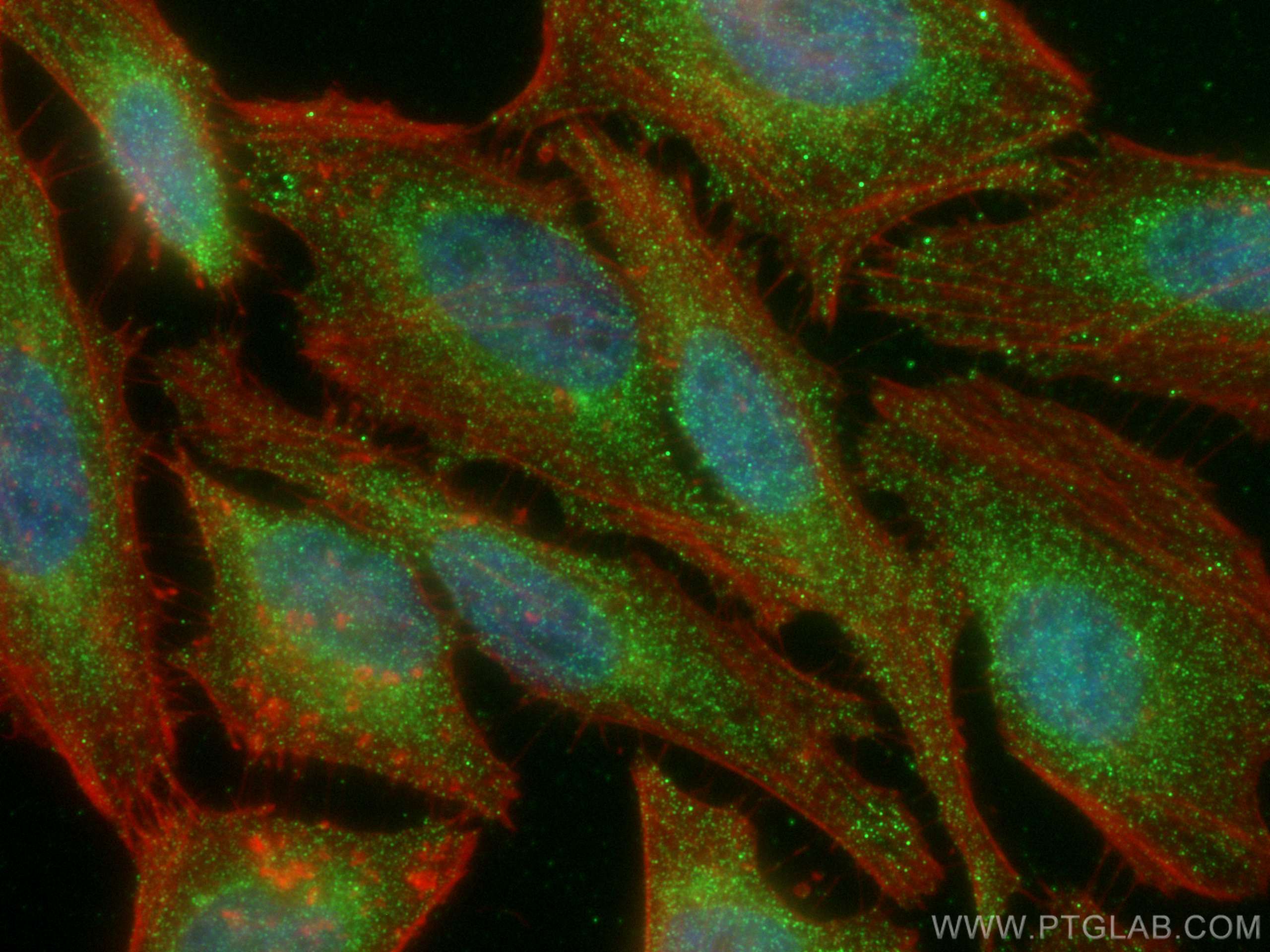 Immunofluorescence (IF) / fluorescent staining of HeLa cells using PSMB8 Monoclonal antibody (66759-1-Ig)