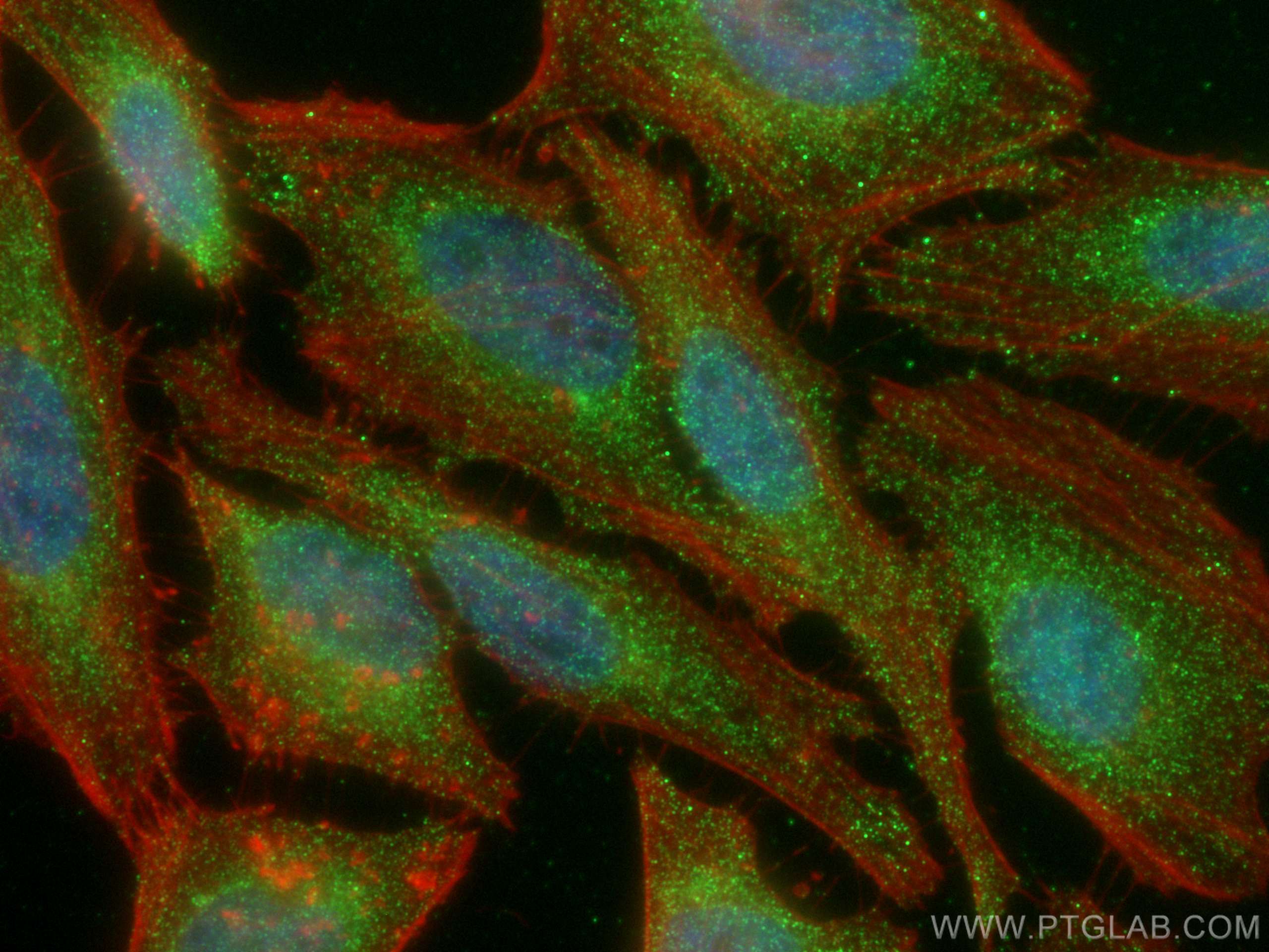 IF Staining of HeLa using 66759-1-Ig