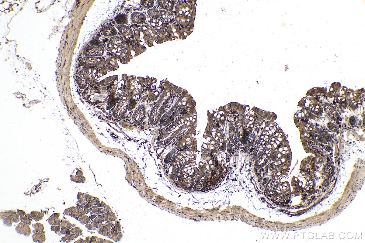 Immunohistochemistry (IHC) staining of mouse colon tissue using PSMB8 Monoclonal antibody (66759-1-Ig)