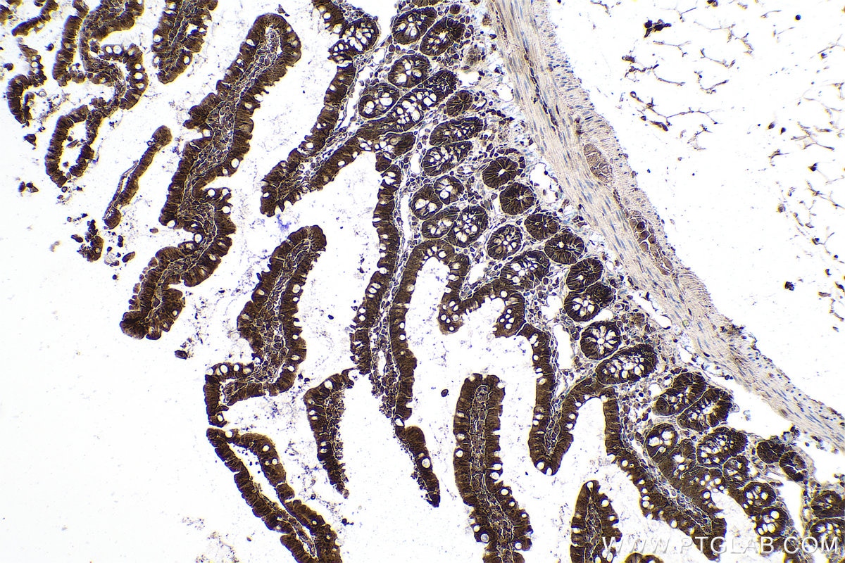 Immunohistochemistry (IHC) staining of rat colon tissue using PSMB8 Monoclonal antibody (66759-1-Ig)