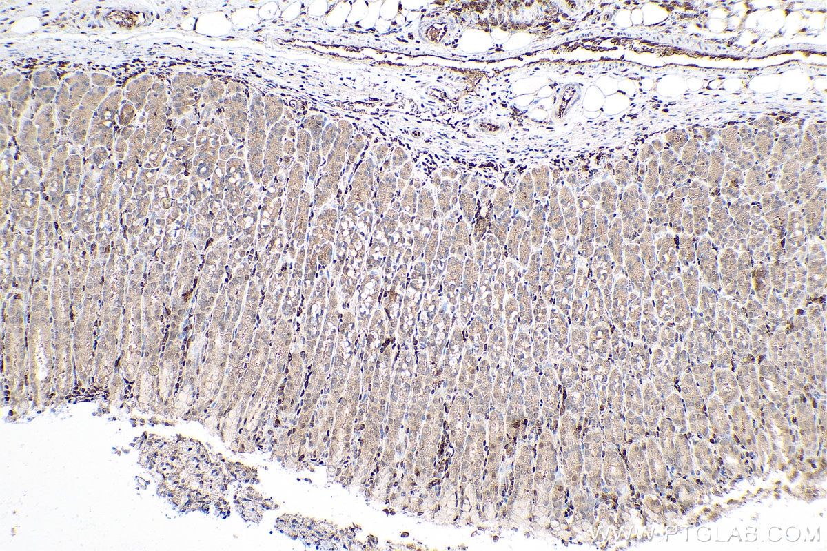 Immunohistochemistry (IHC) staining of rat stomach tissue using PSMB8 Monoclonal antibody (66759-1-Ig)