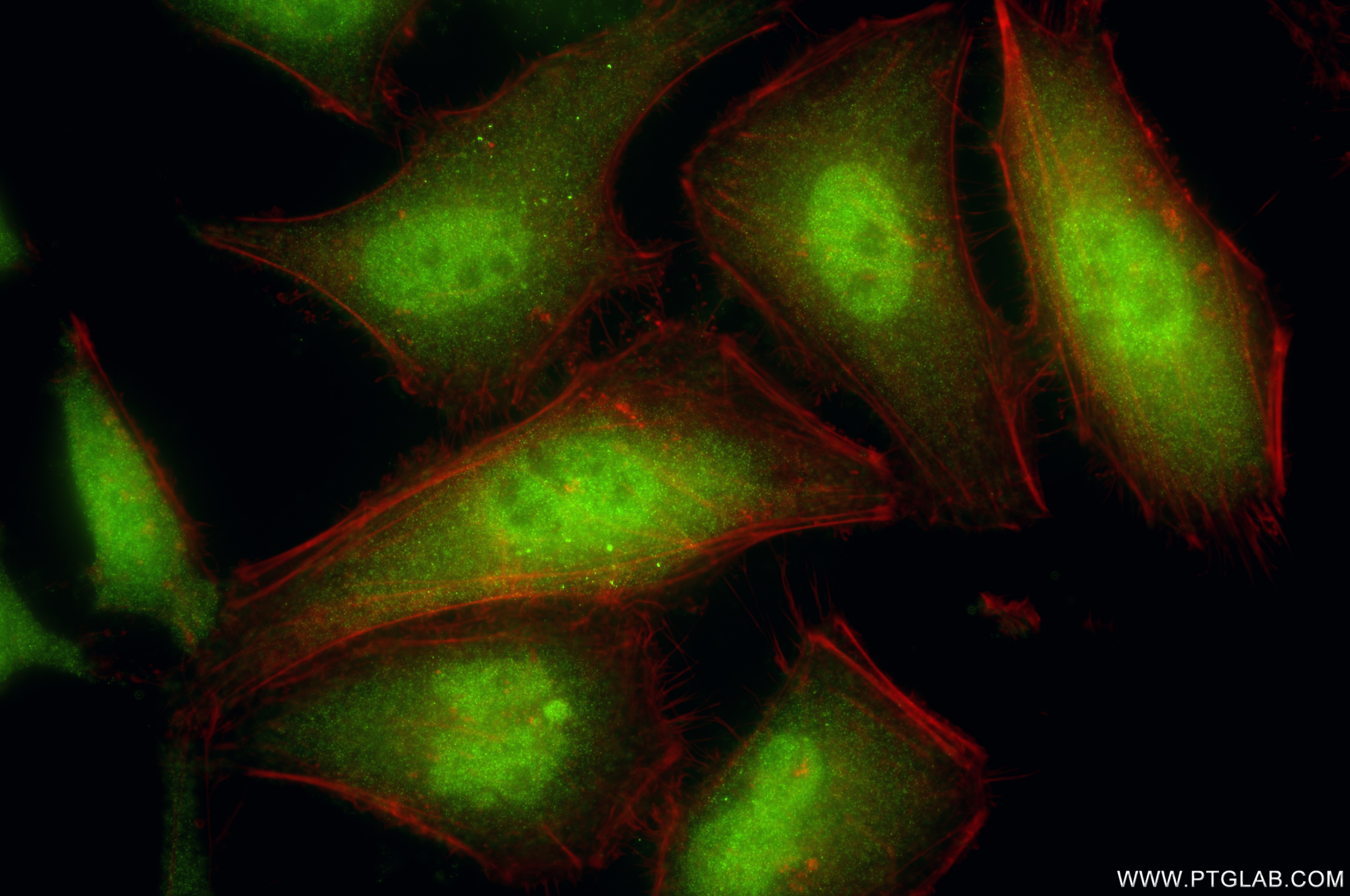Immunofluorescence (IF) / fluorescent staining of HeLa cells using PSMB8 Recombinant antibody (86241-1-RR)
