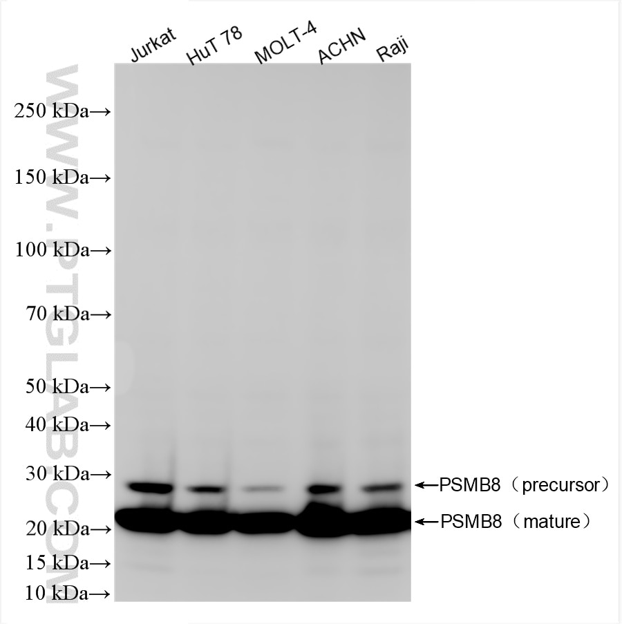Western Blot (WB) analysis of various lysates using PSMB8 Recombinant antibody (86241-1-RR)