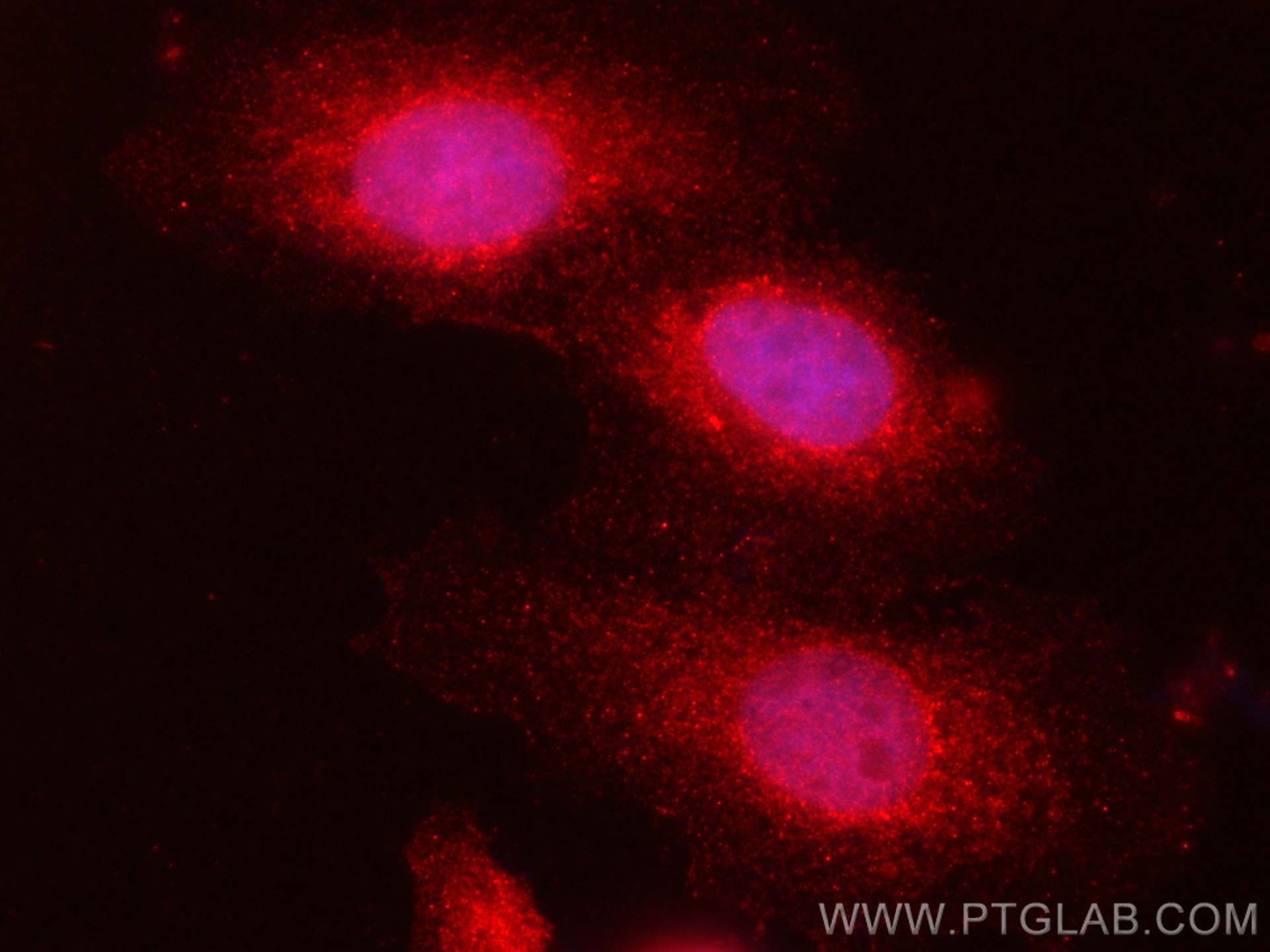 IF Staining of HepG2 using CL594-14859