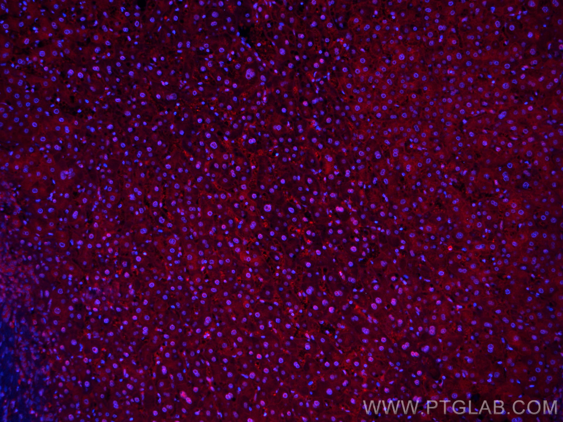 IF Staining of human liver cancer using CL594-66759