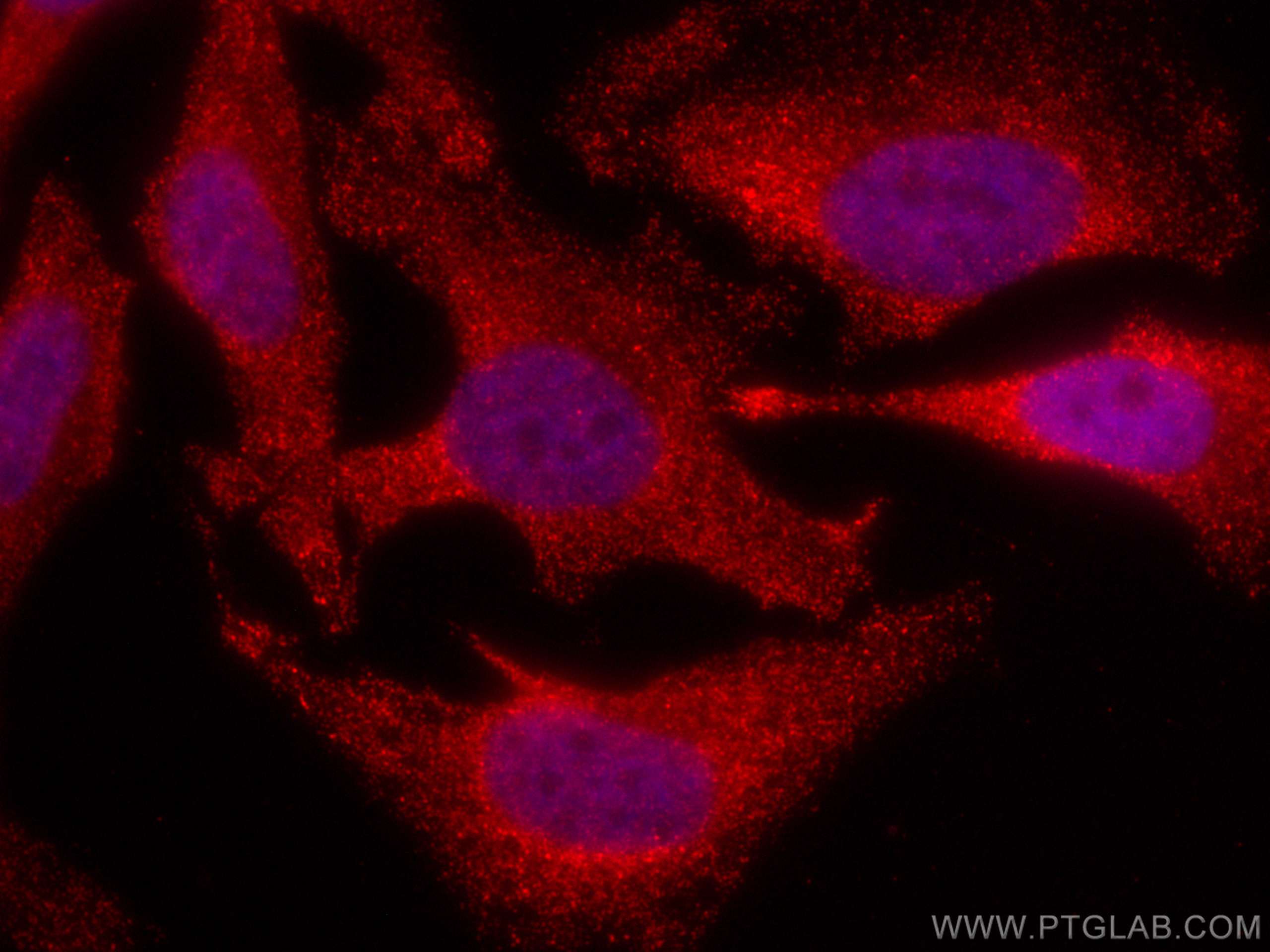 Immunofluorescence (IF) / fluorescent staining of HeLa cells using CoraLite®594-conjugated PSMB8 Monoclonal antibody (CL594-66759)