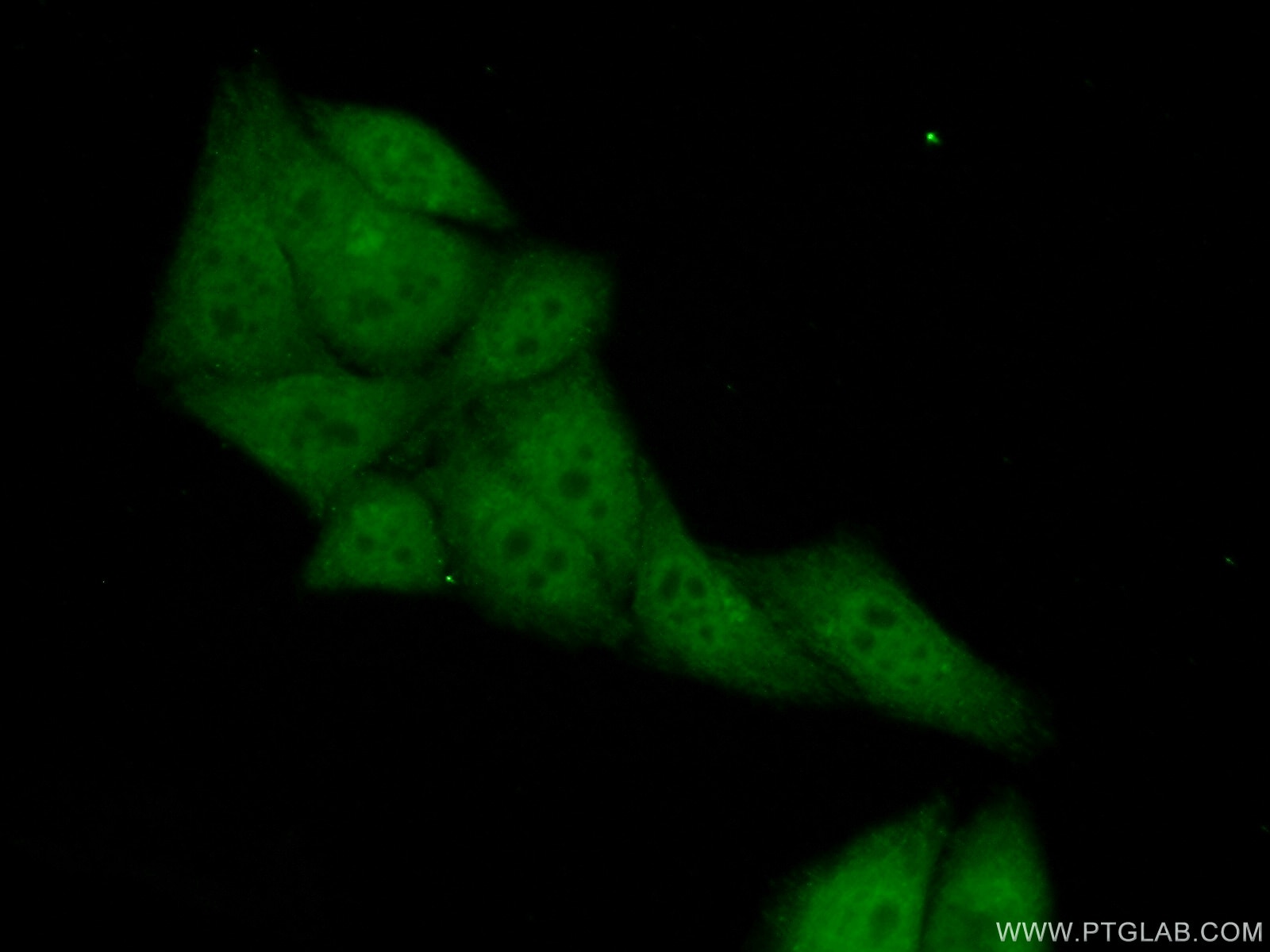 Immunofluorescence (IF) / fluorescent staining of HepG2 cells using PSMB9 Polyclonal antibody (14544-1-AP)