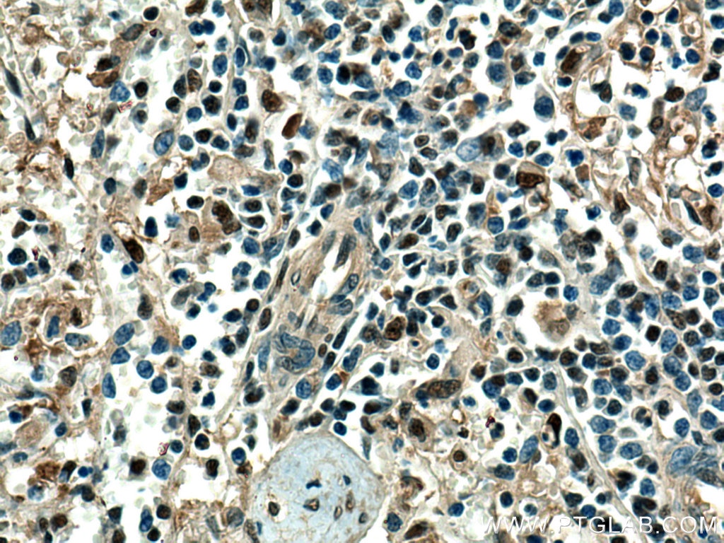 Immunohistochemistry (IHC) staining of human spleen tissue using PSMB9 Polyclonal antibody (14544-1-AP)