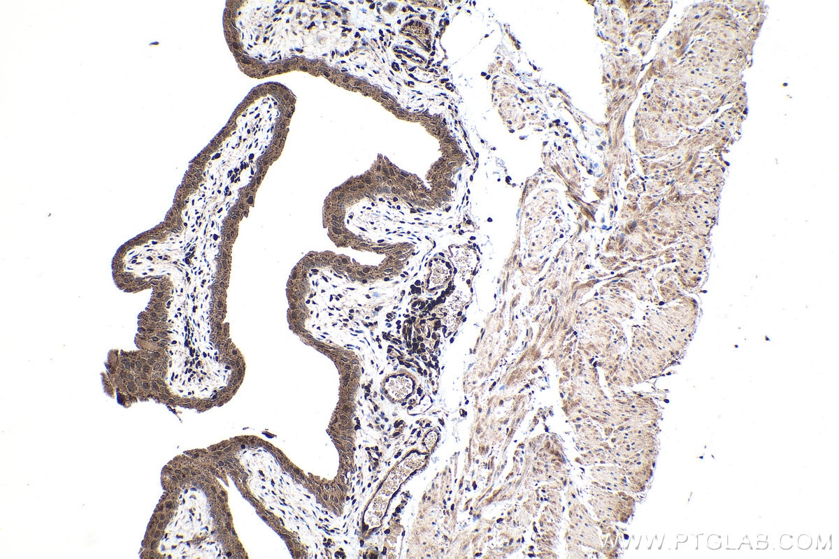 Immunohistochemistry (IHC) staining of mouse bladder tissue using PSMB9 Polyclonal antibody (14544-1-AP)