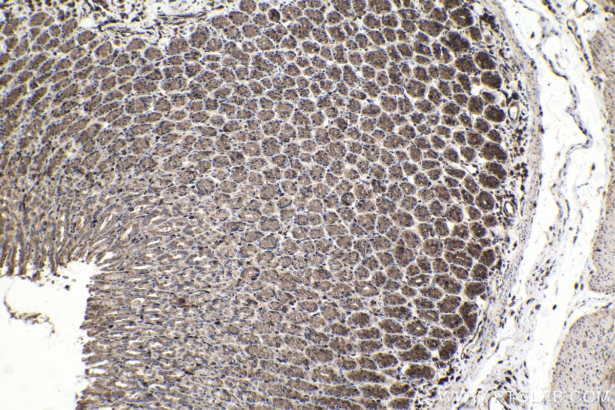 Immunohistochemistry (IHC) staining of rat stomach tissue using PSMB9 Polyclonal antibody (14544-1-AP)