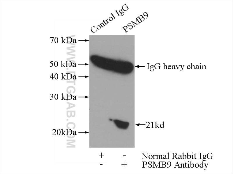 Immunoprecipitation (IP) experiment of Raji cells using PSMB9 Polyclonal antibody (14544-1-AP)