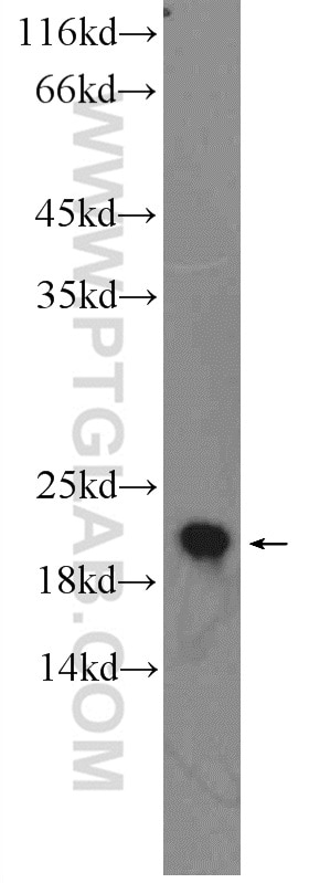 Western Blot (WB) analysis of rat spleen tissue using PSMB9 Polyclonal antibody (14544-1-AP)
