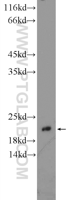 Western Blot (WB) analysis of mouse kidney tissue using PSMB9 Polyclonal antibody (14544-1-AP)