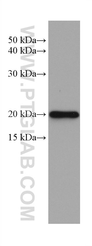 Western Blot (WB) analysis of rat spleen tissue using PSMB9 Monoclonal antibody (67748-1-Ig)