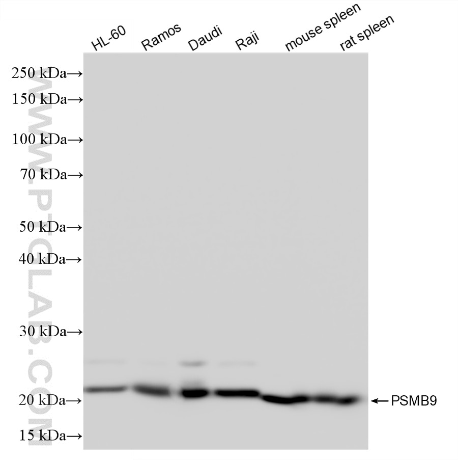Western Blot (WB) analysis of various lysates using PSMB9 Recombinant monoclonal antibody (87013-1-RR)