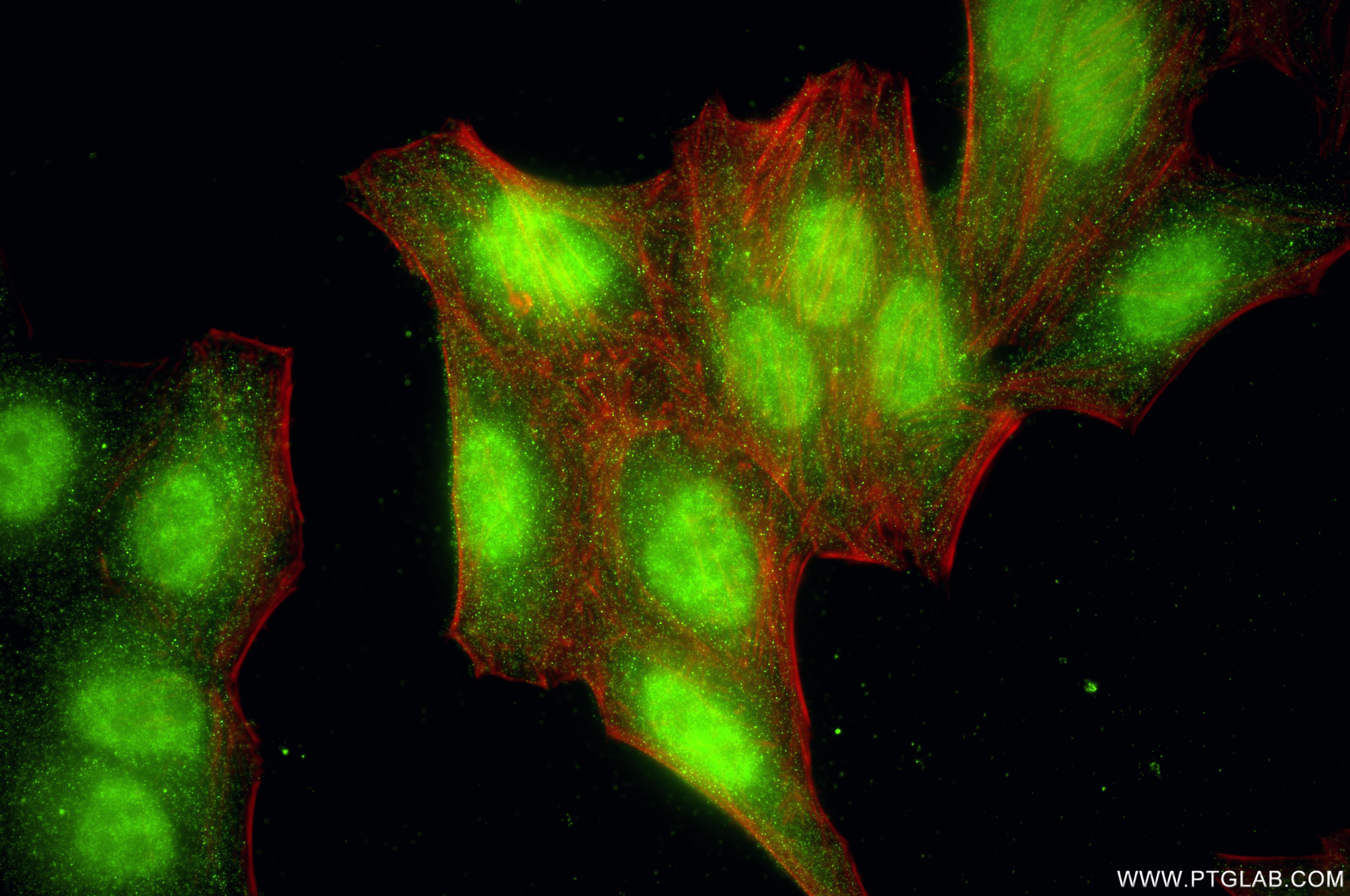 Immunofluorescence (IF) / fluorescent staining of HepG2 cells using PSMB9 Recombinant monoclonal antibody (87013-2-RR)