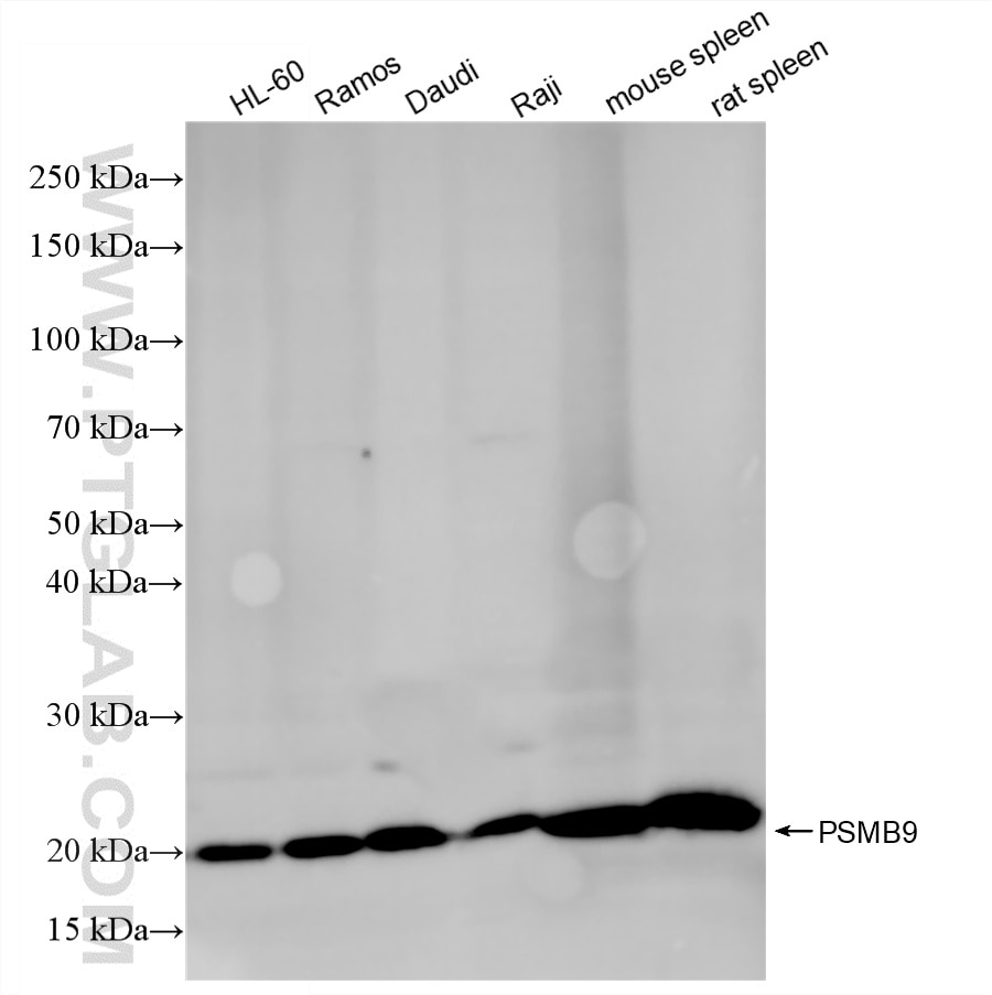 Western Blot (WB) analysis of various lysates using PSMB9 Recombinant monoclonal antibody (87013-2-RR)