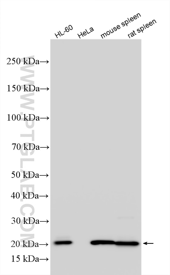 Western Blot (WB) analysis of various lysates using Multi-rAb® PSMB9 Multi-Recombinant antibody (RMX00091)