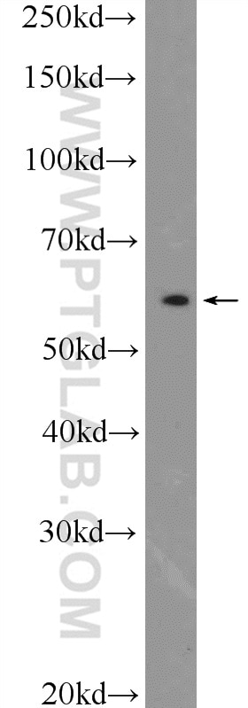 Western Blot (WB) analysis of mouse brain tissue using PSMC1 Polyclonal antibody (11196-1-AP)