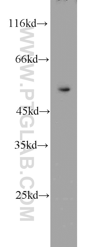 Western Blot (WB) analysis of HeLa cells using PSMC1 Polyclonal antibody (11196-1-AP)