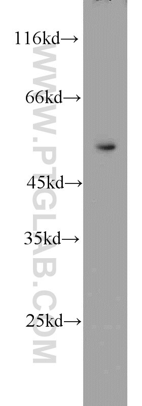 WB analysis of HeLa using 11196-1-AP