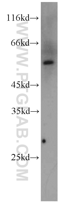 Western Blot (WB) analysis of mouse lung tissue using PSMC1 Polyclonal antibody (11196-1-AP)