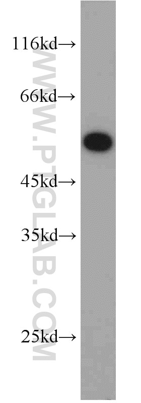 Western Blot (WB) analysis of A549 cells using PSMC1 Polyclonal antibody (11196-1-AP)