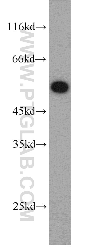 WB analysis of A549 using 11196-1-AP