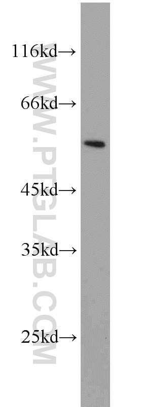 Western Blot (WB) analysis of Jurkat cells using PSMC1 Polyclonal antibody (11196-1-AP)