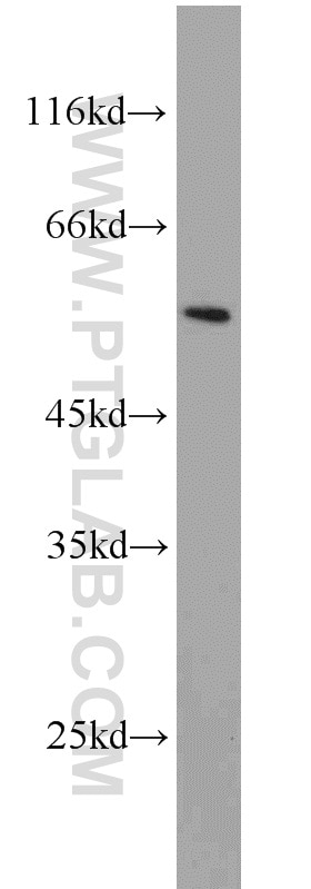 WB analysis of Jurkat using 11196-1-AP