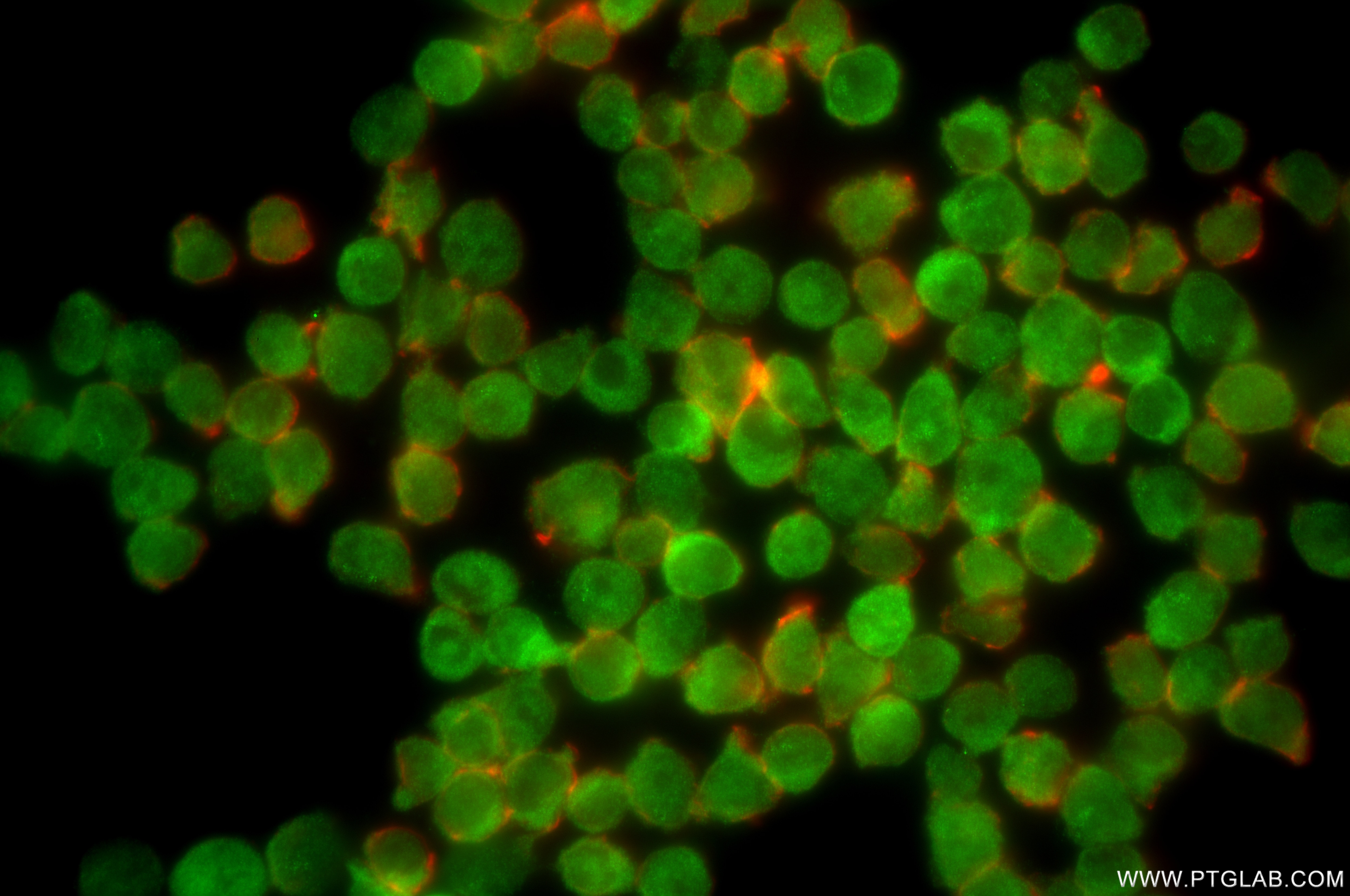Immunofluorescence (IF) / fluorescent staining of Jurkat cells using PSMC1 Recombinant antibody (86237-1-RR)