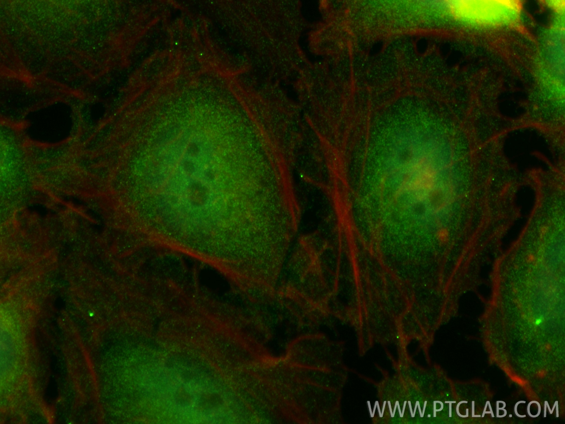 Immunofluorescence (IF) / fluorescent staining of HeLa cells using PSMC2 Polyclonal antibody (14905-1-AP)