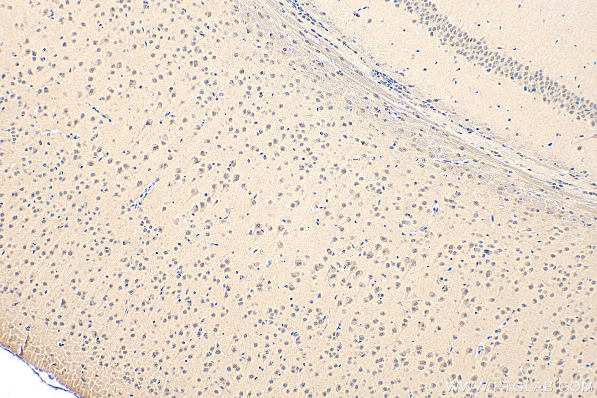 Immunohistochemistry (IHC) staining of mouse brain tissue using PSMC2 Polyclonal antibody (14905-1-AP)