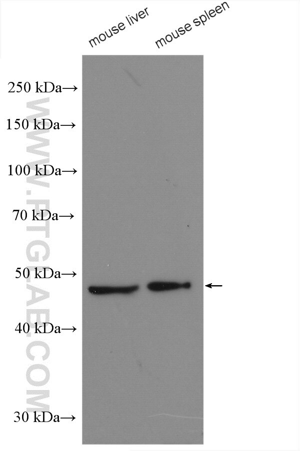 Western Blot (WB) analysis of various lysates using PSMC2 Polyclonal antibody (14905-1-AP)