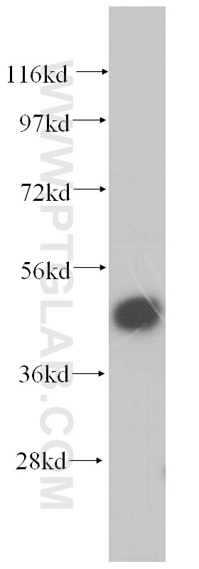 Western Blot (WB) analysis of human adrenal gland tissue using PSMC2 Polyclonal antibody (14905-1-AP)