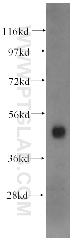 Western Blot (WB) analysis of mouse liver tissue using PSMC2 Polyclonal antibody (14905-1-AP)