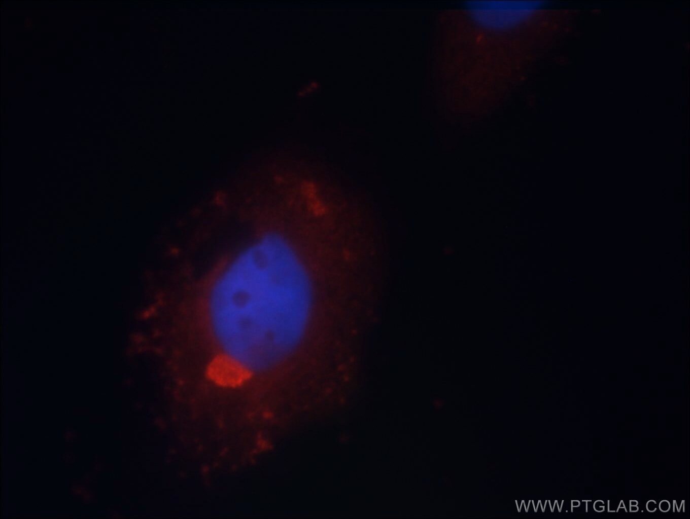 Immunofluorescence (IF) / fluorescent staining of HepG2 cells using PSMC3 Polyclonal antibody (24142-1-AP)