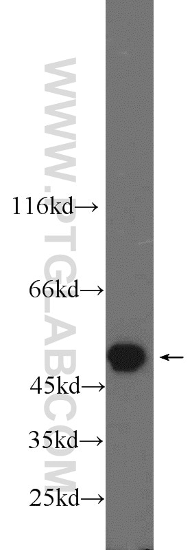 Western Blot (WB) analysis of HeLa cells using PSMC3 Polyclonal antibody (24142-1-AP)