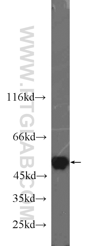 Western Blot (WB) analysis of HEK-293 cells using PSMC3 Polyclonal antibody (24142-1-AP)