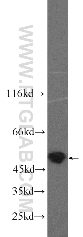 Western Blot (WB) analysis of Jurkat cells using PSMC3 Polyclonal antibody (24142-1-AP)