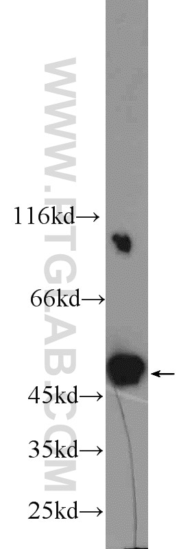 Western Blot (WB) analysis of MCF-7 cells using PSMC3 Polyclonal antibody (24142-1-AP)